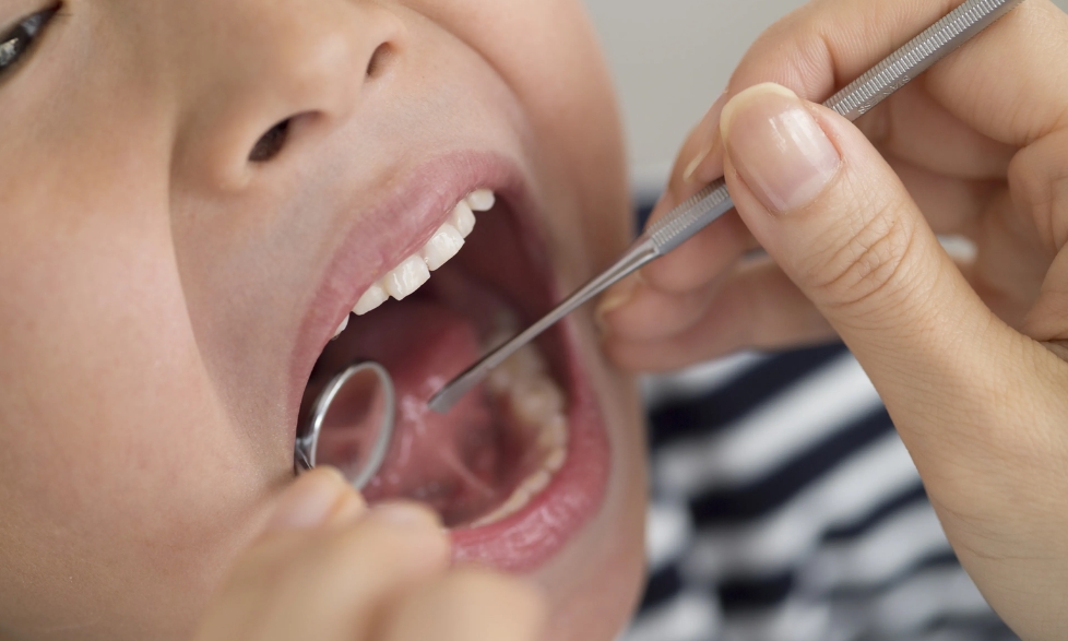 Is a Frenectomy the Key to Easier Feeding?